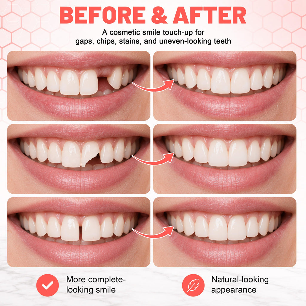 Custom Upper & Lower Dentures J453